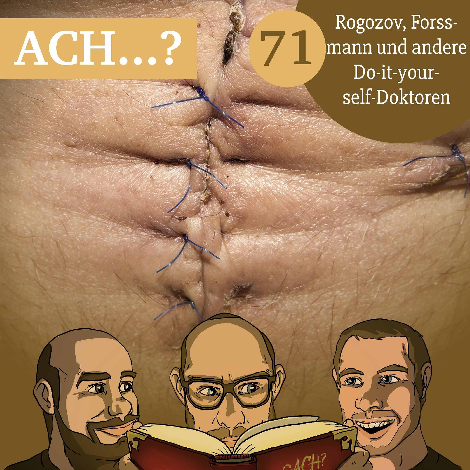 Ach-Podcast: 71 – Rogozov, Forssmann und andere Do-it-yourself-Doktoren